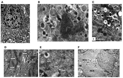 Pancreatic Beta Cell Identity in Humans and the Role of Type 2 .